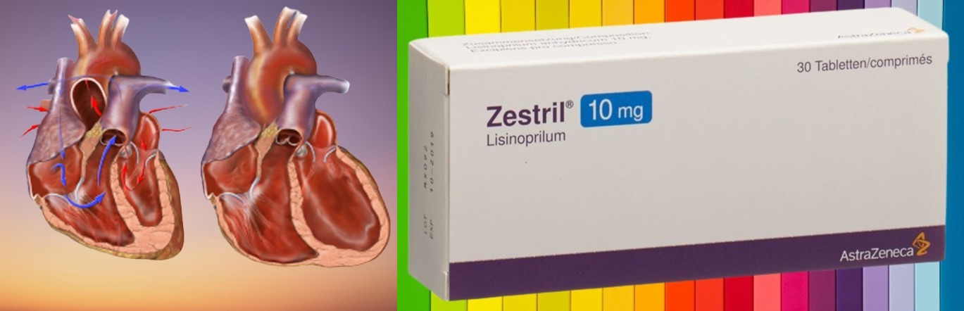 Lisinopril (ZESTRIL) For High Blood Pressure | How To Take It Correctly + Side Effects